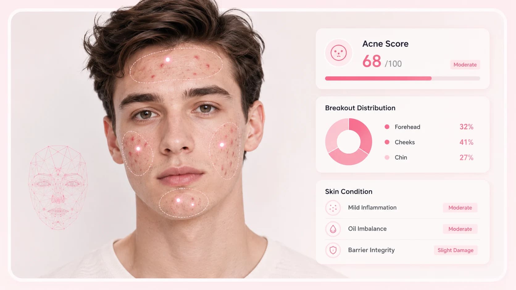 Wrinkle scanner with fine line skin age and dark circle analysis